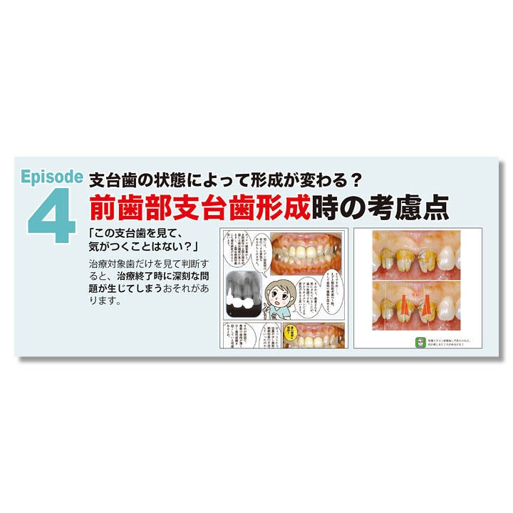 683 マンガで学ぶ はじめての前歯部修復 成功のために押さえておきたい