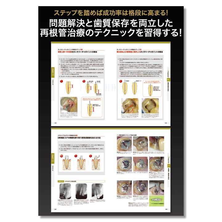 682 ビジュアル歯内療法学 生物学的コンセプトとテクニックのすべて