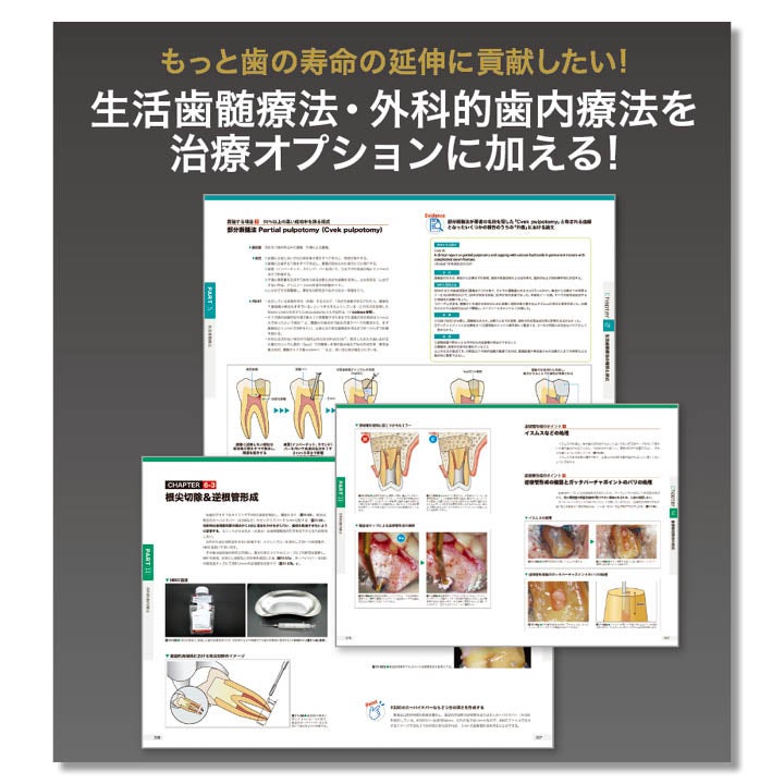 682 ビジュアル歯内療法学 生物学的コンセプトとテクニックのすべて