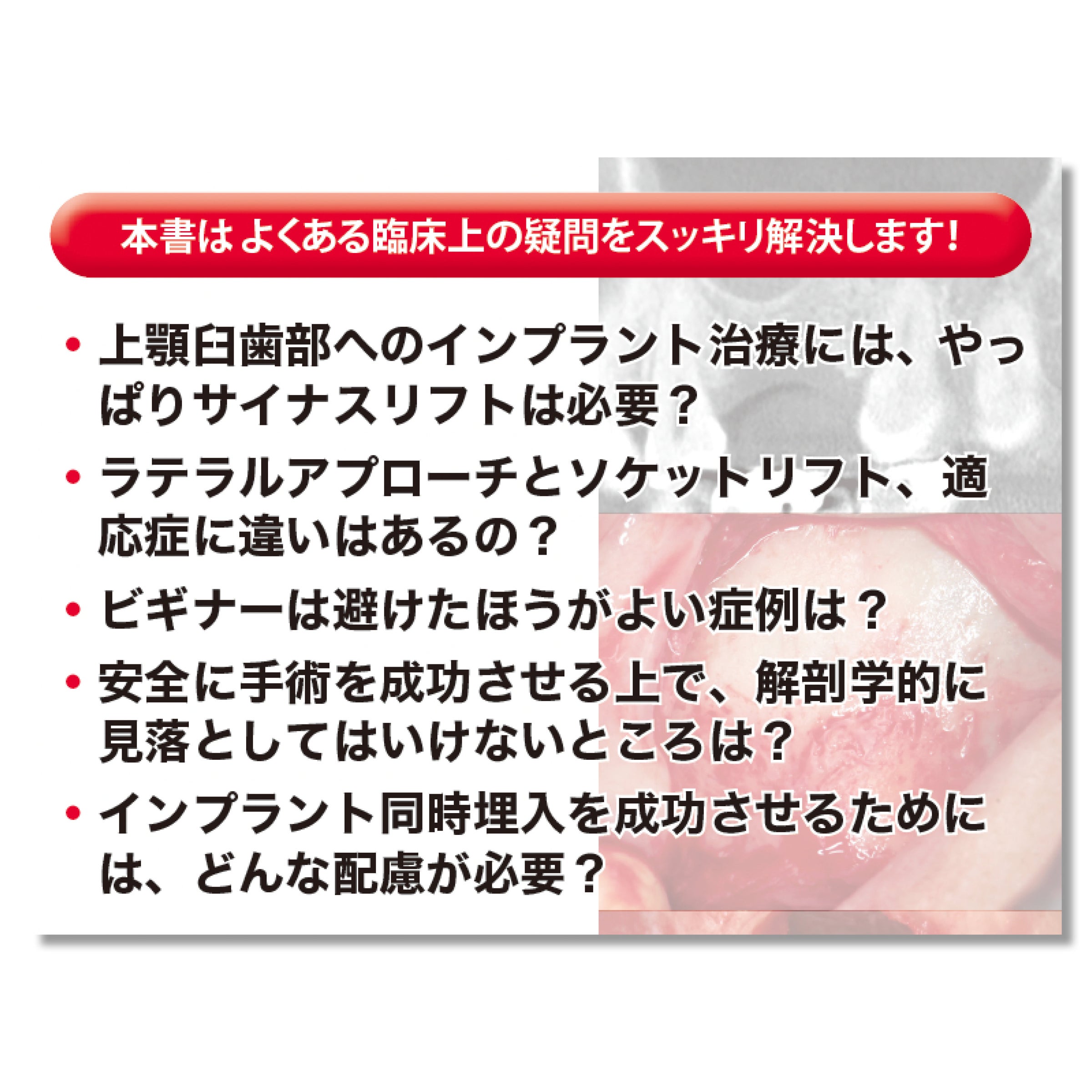 662 無理なくできるサイナスリフト導入マニュアル | Shop Co.