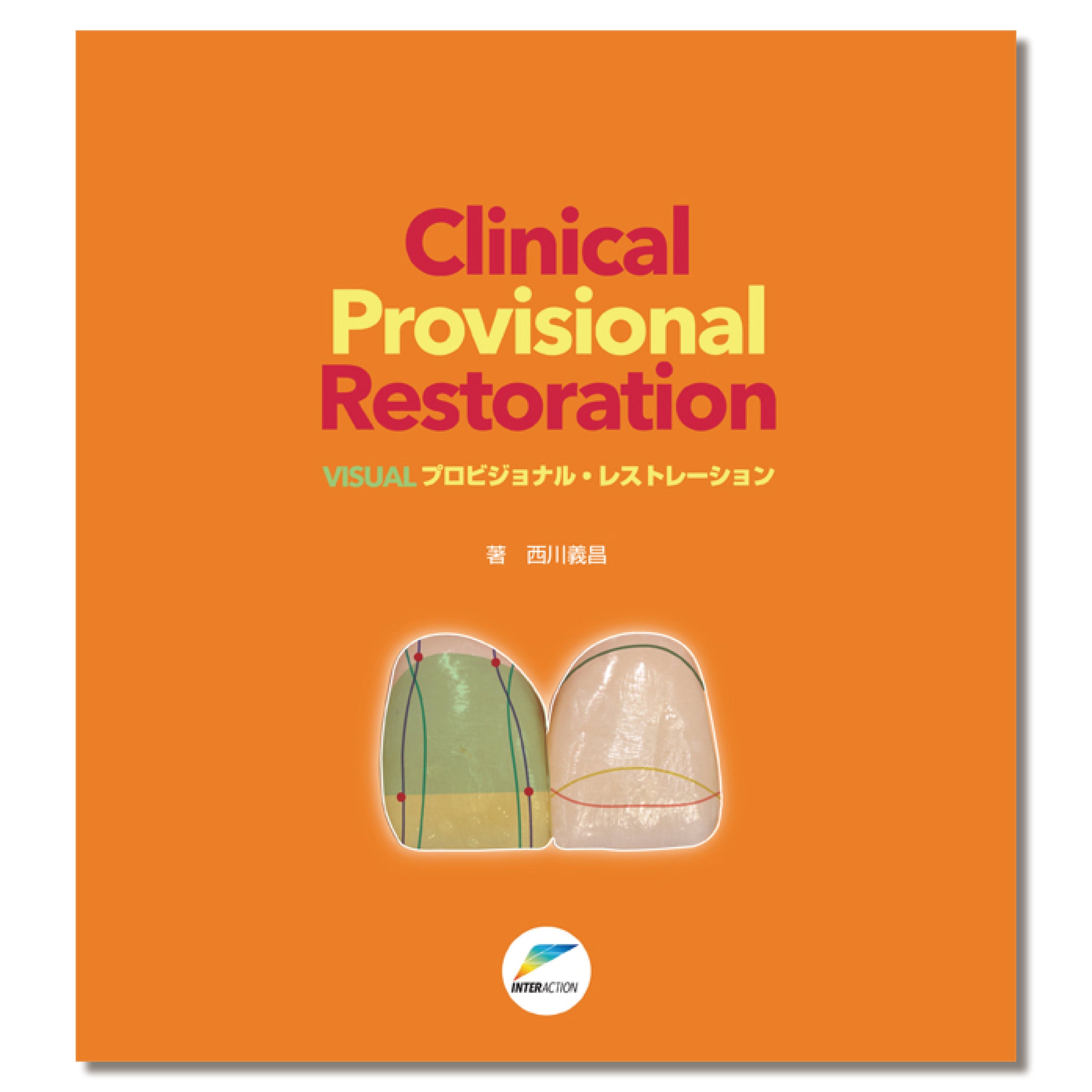 615 【西川義昌先生シリーズ3】Clinical Provisional Restoration