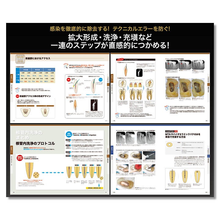 682 ビジュアル歯内療法学 生物学的コンセプトとテクニックのすべて
