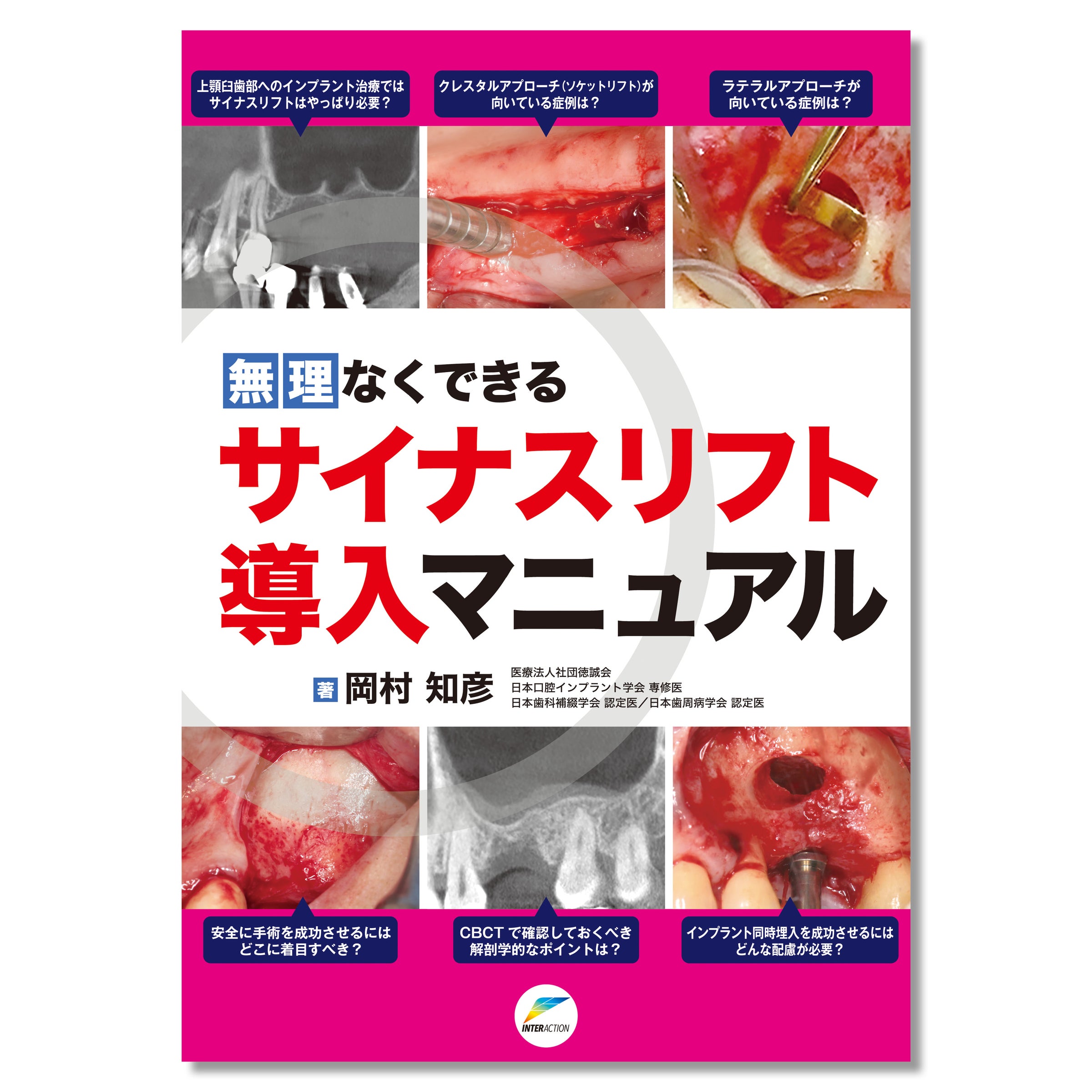 662 無理なくできるサイナスリフト導入マニュアル | Shop Co.