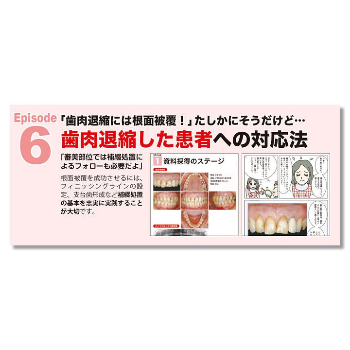 683 マンガで学ぶ はじめての前歯部修復 成功のために押さえておきたい