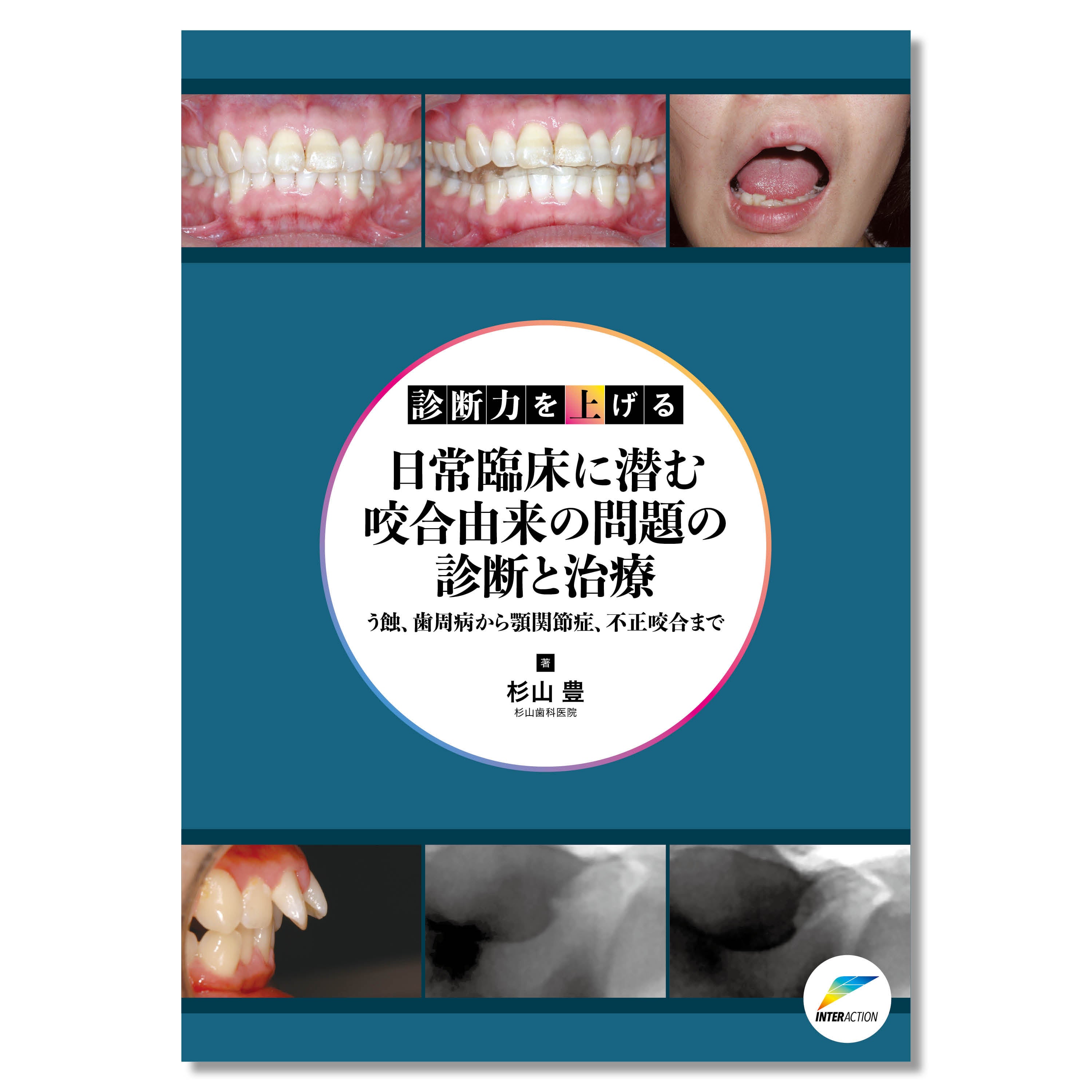 歯周再生療法を成功させるテクニックとストラテジー 裁断済】歯周再生療法
