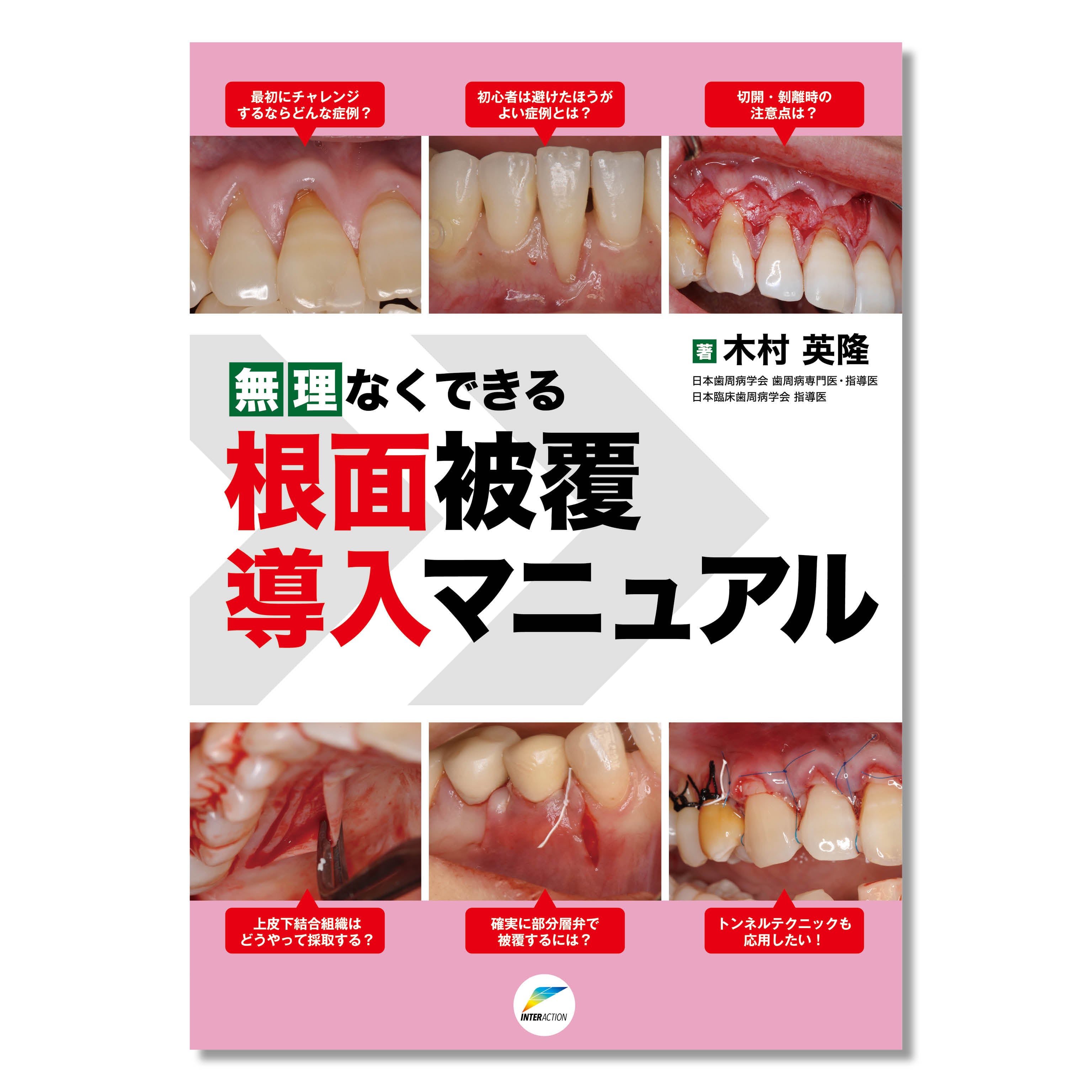 歯周外科の臨床とテクニック - 本